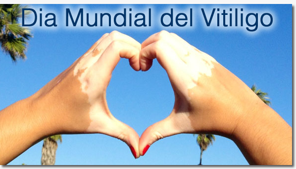 Efemérides: 25 de junio, Día Mundial del Vitiligo