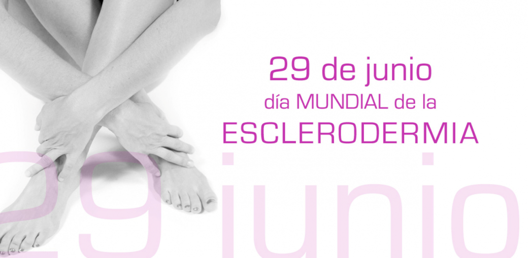 Efemérides: 29 de Junio, Día Mundial de la Esclerodermia
