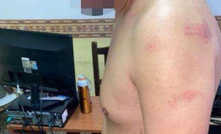 Le fue infiel y ella, experta en artes marciales, lo molió a golpes