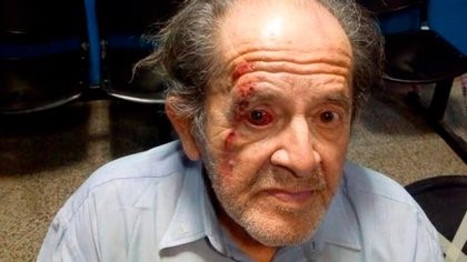 Guardia de supermercado golpeó a un jubilado que quedó internado en terapia intensiva