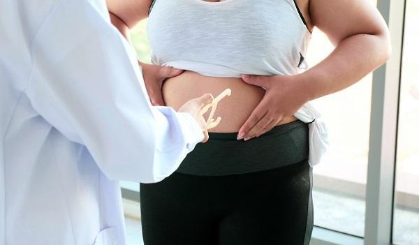 Obesidad: 6 de cada 10 adultos presentan exceso de peso