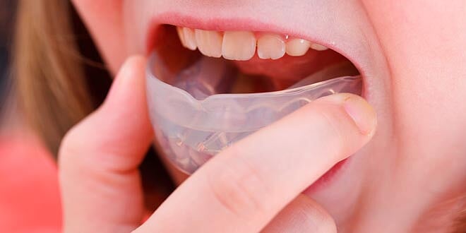 Traumatismos dentales: ¿Qué hacer y cómo prevenirlos?
